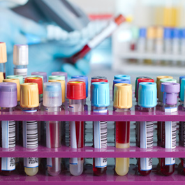 Empfehlungen des Swiss Medical Board zur oralen und parenteralen Eisensubstitution