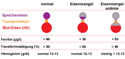 progressiver eisenmange